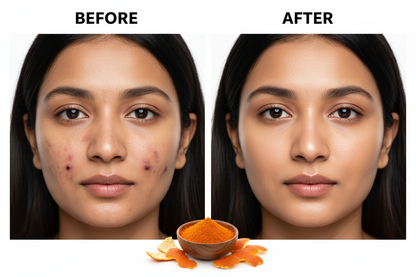 aftar before ki picture clear kra